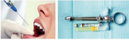 胰島素，牙科麻醉6.png